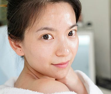 Microneedling with PRP